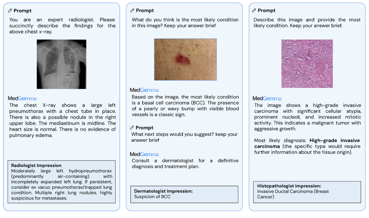 MedGemma i jego zastosowanie w diagnostyce i analizie danych medycznych